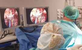 Premieră în Moldova O femeie cu tumoare la plămîni operată prin videotoracoscopie